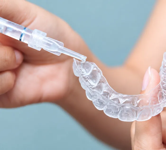 Whitening gel being placed into a clear dental tray