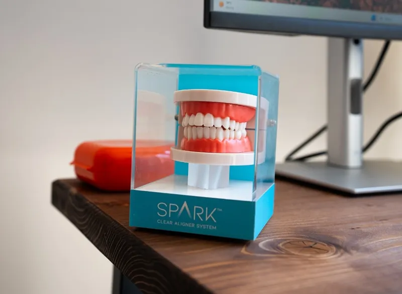 Clear aligner model used to explain dentist-led teeth straightening
